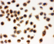 ICC testing of Cytochrome C antibody and SMMC-7721 cells