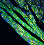Immunofluorescent staining of FFPE mouse heart tissue with Cytochrome C antibody (green) at 1ug/ml and DAPI nuclear stain (blue). HIER: steam section in pH6 citrate buffer for 20 min.