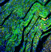 Immunofluorescent staining of FFPE rat heart tissue with Cytochrome C antibody (green) at 1ug/ml and DAPI nuclear stain (blue). HIER: steam section in pH6 citrate buffer for 20 min.