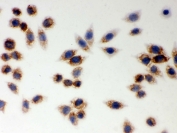 ICC testing of FFPE human SMMC-7721 cells with LYRIC antibody. HIER: steam section in pH6 citrate buffer for 20 min and allow to cool prior to testing.