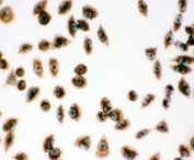 ICC testing of PRDX1 antibody and human SMMC-7721 cells.