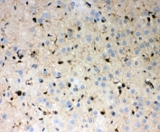IHC-P testing of rat brain tissue with PRDX1 antibody. HIER: steamed with pH6 citrate buffer.