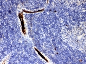 IHC-P: Alpha 1 Antitrypsin antibody testing of rat spleen tissue