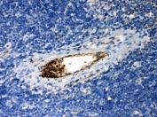 IHC-P: Alpha 1 Antitrypsin antibody testing of mouse spleen tissue