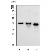 Western blot testing of human 1) HeLa, 2) HaCaT and 3) Caco-2 cell lysate with SERPINB5 antibody. Predicted molecular weight: 42~45 kDa.