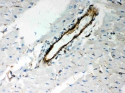 IHC-P: Vimentin antibody testing of rat heart. Required HIER: boil tissue sections in pH8 EDTA for 20 min and allow to cool before testing.