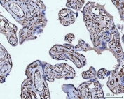 IHC staining of FFPE human placental tissue with Vimentin antibody. HIER: boil tissue sections in pH8 EDTA for 20 min and allow to cool before testing.
