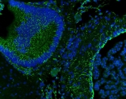 Immunofluorescent staining of FFPE rat brain tissue with Vimentin antibody (green) and DAPI nuclear stain (blue). HIER: boil tissue sections in pH8 EDTA for 20 min and allow to cool before testing.