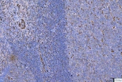 IHC staining of FFPE human tonsil tissue with Vimentin antibody. HIER: boil tissue sections in pH8 EDTA for 20 min and allow to cool before testing.