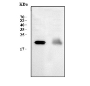 Western blot testing of 1) human HepG2 and 2) human HCCP cell lysate with RBP4 antibody. Predicted molecular weight: ~23 kDa.