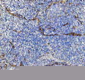 IHC staining of FFPE human tonsil tissue with P-Selectin antibody, HRP-labeled secondary and DAB substrate. HIER: boil tissue sections in pH8 EDTA for 20 min and allow to cool before testing.