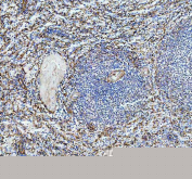 IHC staining of FFPE human spleen tissue with P-Selectin antibody, HRP-labeled secondary and DAB substrate. HIER: boil tissue sections in pH8 EDTA for 20 min and allow to cool before testing.