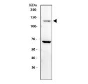 Western blot testing of human HEL cell lysate with P-Selectin antibody. Predicted molecular weight ~91 kDa but may be observed at higher molecular weights due to glycosylation.