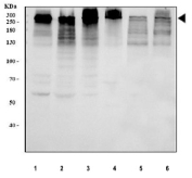Western blot testing of 1) K562, 2) human ThP-1, 3) human Jurkat, 4) human SH-SY5Y, 5) mouse testis and 6) mouse thymus tissue lysate with ARID1A antibody. Predicted molecular weight ~242 kDa, commonly observed at 242-270 kDa.