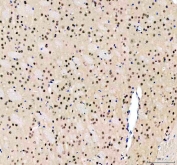 IHC staining of FFPE mouse brain tissue with CLOCK antibody. HIER: boil tissue sections in pH8 EDTA for 20 min and allow to cool before testing.