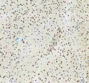IHC staining of FFPE rat brain tissue with CLOCK antibody. HIER: boil tissue sections in pH8 EDTA for 20 min and allow to cool before testing.