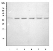Western blot testing of 1) human HepG2, 2) human HeLa, 3) human A431, 4) rat lung, 5) mouse lung and 6) mouse NIH 3T3 cell lysate with SLUG antibody. Predicted molecular weight ~29 kDa.