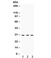Western blot testing of 1) rat brain, 2) rat skeletal muscle and 3) human PANC lysate with PRKAB2 antibody. Expected molecular weight ~30 kDa.