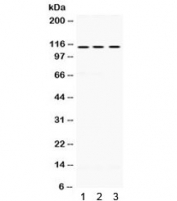 Western blot testing of 1) rat brain, 2) mouse brain and 3) human HeLa lysate with UNC5C antibody. Predicted molecular weight ~103 kDa, observed here at ~115 kDa.