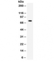 Western blot testing of human HeLa cell lysate with Pokemon antibody. Predicted molecular weight ~61 kDa but routinely observed at ~75 kDa.