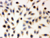 ICC testing of human SMCC-7221 cells and AIF antibody.