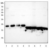 Western blot testing of 1) human HeLa, 2) human MCF7, 3) human T-47D, 4) human PC-3, 5) rat brain, 6) rat C6, 7) mouse brain and 8) mouse Neuro-2a cell lysate with SOD1 antibody. Predicted molecular weight ~16 kDa.