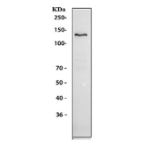 Western blot testing of human HepG2 cell lysate with Ceruloplasmin antibody. Predicted molecular weight ~122 kDa but may be observed at higher molecular weights due to glycosylation.