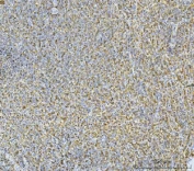 IHC staining of FFPE human spleen tissue with Carbonic Anhydrase I antibody. HIER: boil tissue sections in pH8 EDTA for 20 min and allow to cool before testing.