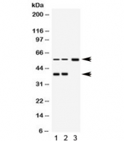 Western blot testing of 1) rat brain, 2) human RH35 and 3) human MCF7 lysate with AHSG antibody. Expected molecular weight ~39 (unmodified), 45-55 kDa (glycosylated).