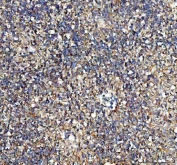 IHC staining of FFPE human spleen tissue with ATP1A1 antibody. HIER: boil tissue sections in pH8 EDTA for 20 min and allow to cool before testing.