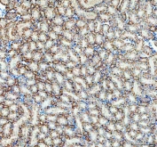 IHC staining of FFPE mouse kidney tissue with ATP1A1 antibody. HIER: boil tissue sections in pH8 EDTA for 20 min and allow to cool before testing.