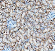 IHC staining of FFPE rat kidney tissue with ATP1A1 antibody. HIER: boil tissue sections in pH8 EDTA for 20 min and allow to cool before testing.