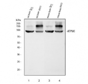 Western blot testing of 1) rat brain, 2) rat brain, 3) mouse brain and 4) mouse brain tissue lysate with ATP1A1 antibody. Predicted molecular weight: 74-113 kDa (multiple isoforms).