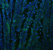 Immunofluorescent staining of FFPE human colon cancer tissue with ATP1A1 antibody (green) and DAPI nuclear stain (blue). HIER: steam section in pH8 EDTA buffer for 20 min.