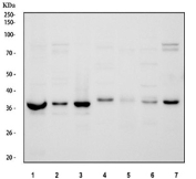Western blot testing of 1) human K562, 2) human HeLa, 3) human Jurkat, 4) rat brain, 5) rat spleen, 6) mouse brain and 7) mouse spleen tissue lysate with DNA polymerase beta antibody. Predicted molecular weight ~38 kDa.