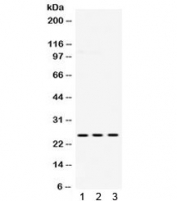 Western blot testing of 1) rat brain, 2) mouse brain and 3) human U87 lysate with PGP 9.5 antibody. Expected/observed molecular weight ~25 kDa.