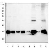 Western blot testing of 1) human RT4, 2) human A549, 3) human U-251, 4) human SiHa, 5) rat testis, 6) rat liver, 7) mouse testis and 8) mouse liver tissue lysate with MGST1 antibody. Predicted molecular weight ~17 kDa.