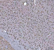 IHC staining of FFPE mouse brain tissue with GRP78 antibody. HIER: boil tissue sections in pH8 EDTA for 20 min and allow to cool before testing.