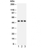 Western blot testing of 1) human PANC, 2) A549 and 3) HT1080 lysate with SLC2A2 antibody. Expected molecular weight: 57~70 kDa depending on glycosylation level, observed here at ~50 kDa.