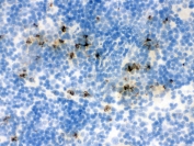 IHC testing of frozen mouse spleen tissue with Lipocalin 2 antibody.