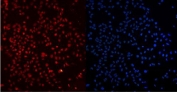 Immunofluorescent staining of FFPE human U-2 OS cells with Ku80 antibody (red) and DAPI nuclear stain (blue). HIER: Boil the paraffin sections in pH 6, 10mM citrate buffer for 20 minutes and allow to cool prior to staining.