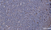 IHC staining of FFPE human tonsil with GRP94 antibody. HIER: boil tissue sections in pH8 EDTA for 20 min and allow to cool before testing.