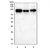 Western blot testing of human 1) Raji, 2) Ramos and 3) Daudi cell lysate with anti-CD19 antibody. Expected molecular weight: 60~100 kDa depending on glycosylation level.