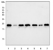 Western blot testing of human 1) HeLa, 2) A431, 3) HepG2, 4) K562, 5) MCF7, 6) A375 and 7) MOLT4 cell lysate with NM23 antibody. Expected molecular weight: 17/20 kDa (NM23-H1A/-H1B).