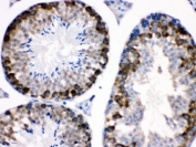 IHC testing of FFPE mouse testis with Stathmin 1 antibody. HIER: Boil the paraffin sections in pH 6, 10mM citrate buffer for 20 minutes and allow to cool prior to staining.