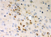 IHC testing of FFPE rat brain tissue with Stathmin 1 antibody. HIER: Boil the paraffin sections in pH 8 EDTA for 20 minutes and allow to cool prior to staining.