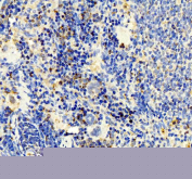 IHC staining of FFPE rat spleen tissue with IP10 antibody. HIER: boil tissue sections in pH8 EDTA for 20 min and allow to cool before testing.