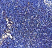 IHC staining of FFPE mouse spleen tissue with IP10 antibody. HIER: boil tissue sections in pH8 EDTA for 20 min and allow to cool before testing.