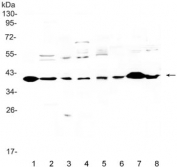 Western blot testing of 1) rat heart, 2) rat brain, 3) rat liver, 4) rat PC-12, 5) human U-87 MG, 6) mouse kidney, 7) mouse heart and 8) mouse brain lysate with IGFBP3 antibody. Expected molecular weight: 31-44 kDa depending on level of glycosylation.