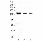 Western blot testing of 1) human Raji and 2) rat thymus and 3) mouse thymus lysate with CD22 antibody. Expected molecular weight: 76/95 kDa (alpha/beta, unmodified), 130-150 kDa (glycosylated).